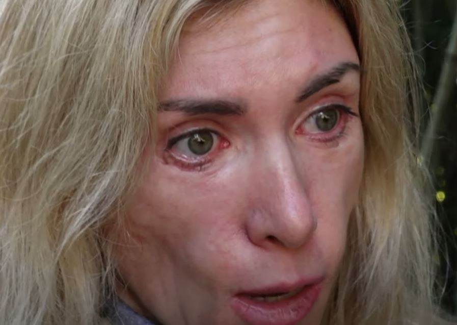  Julija je tužila lekare koji su joj napravi horor od lica 