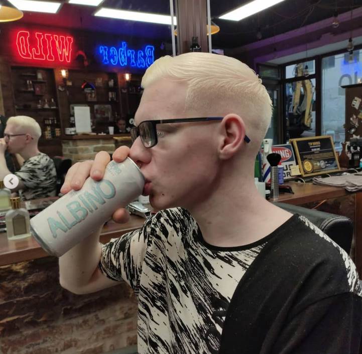  On je Albino, što je iskoristio kao svoje unikatno umetničko ime. 