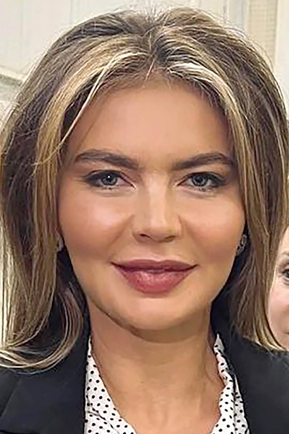  Alina Kabajeva iznenadila svojim plastičnim izgledom lica. 