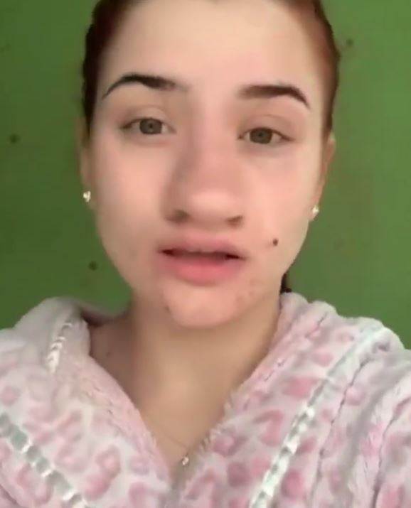 olga baderuk operacija nosa