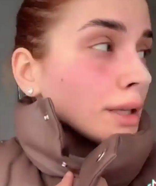 olga baderuk operacija nosa