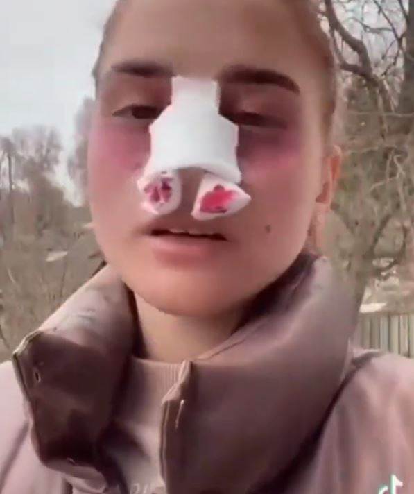 olga baderuk operacija nosa