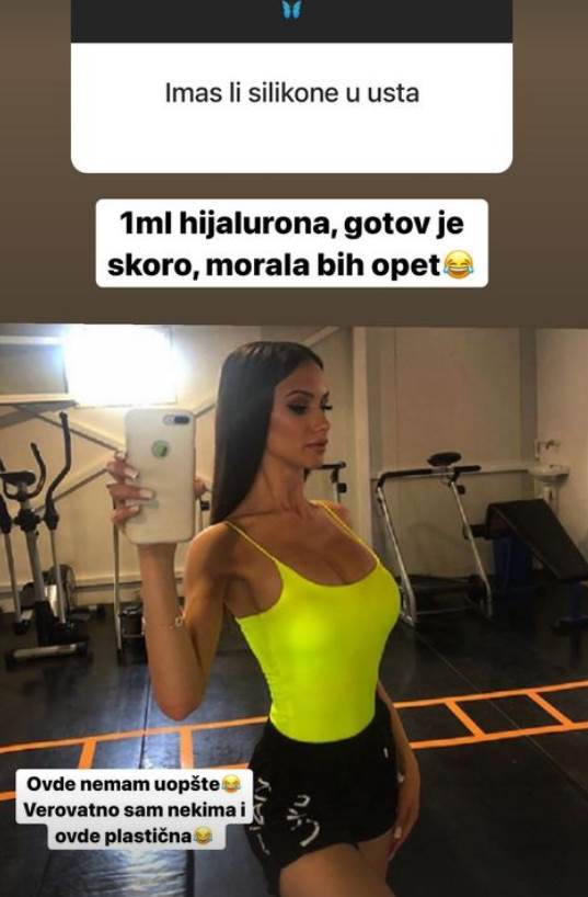 Sara Damjanović o plastičnim operacijama na svom telu