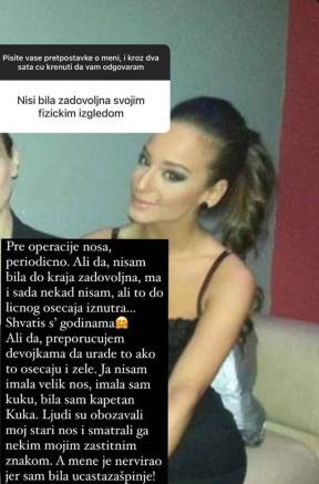 Zašto Edita Aradinović nema više filere u usnama