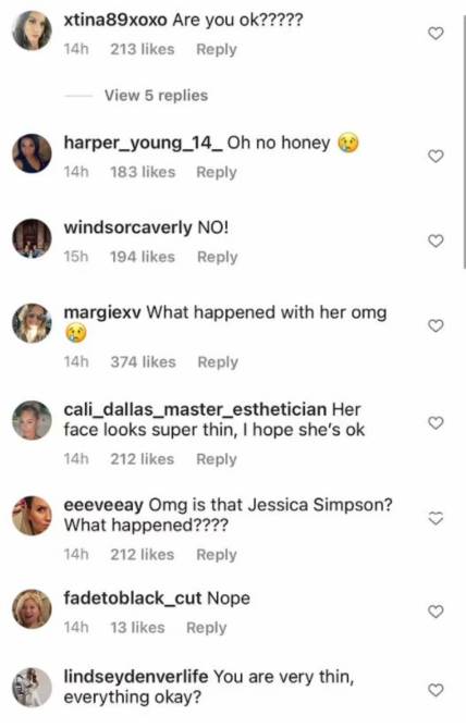 Džesika Simpson našla se na meti kritika da je na granici anoreksije nakon poslednjeg posta.