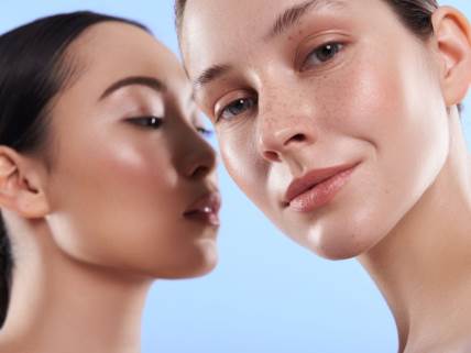 5 prirodnih načina za rešavanje hiperpigmentacije na koži
