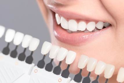 Kako izbeliti zube bez oštećenja gleđi?