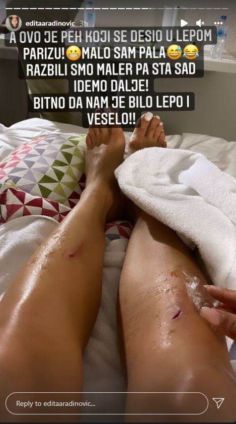 edita aradinovic povrede na nogama