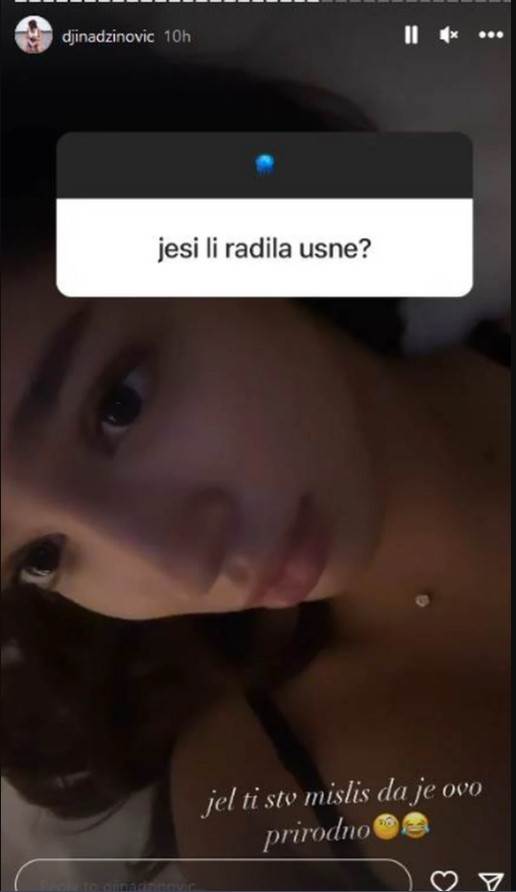 đina džinović priznala da je radila usne.